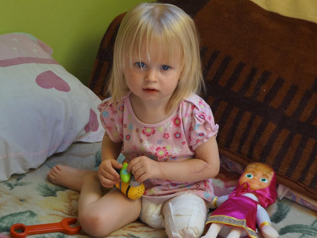2-letnia Natalka z Puław po wypadku
