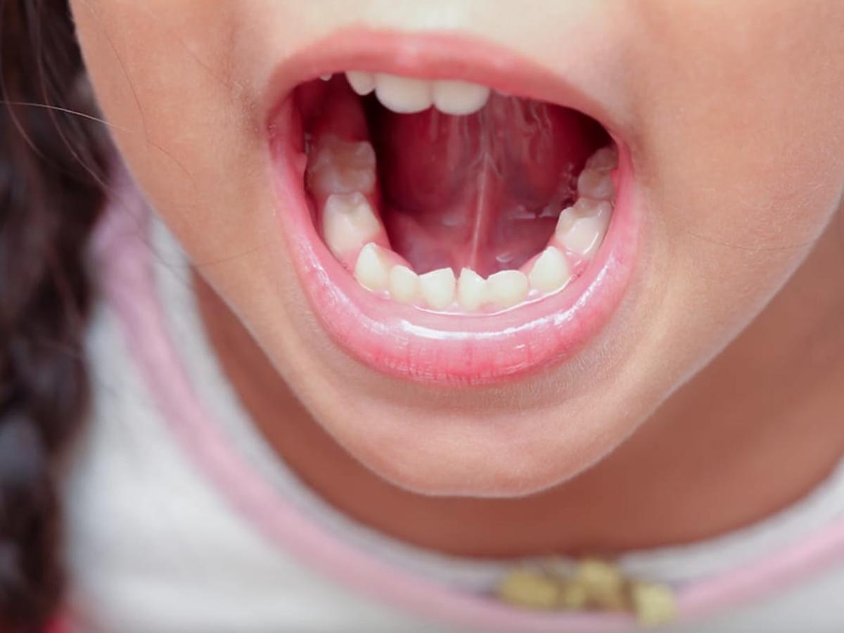 ile zębów mlecznych ma zdrowe dziecko 