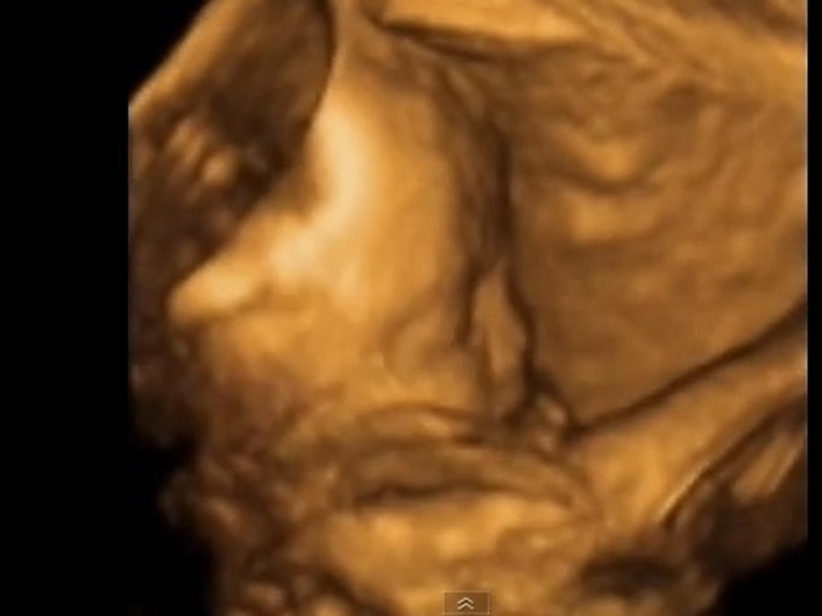 26 tydzień ciąży, usg w ciąży, film z usg w ciąży, usg 4D, usg 3D