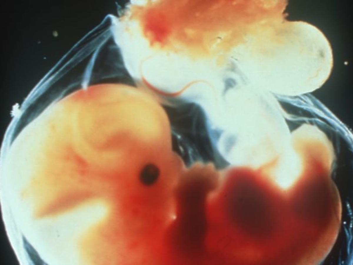 4 tydzień ciąży - jak wygląda dziecko