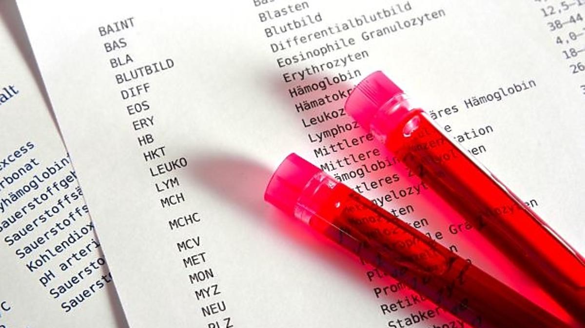 RDW SD w wynikach morfologii normy, interpretacja wyniku