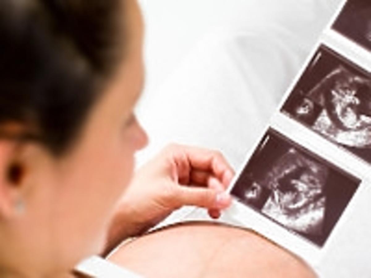 Folik - kobieta w ciąży ogląda USG