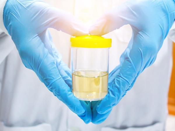 Fosforany Bezpostaciowe W Moczu U Ciężarnej mamotoja.pl