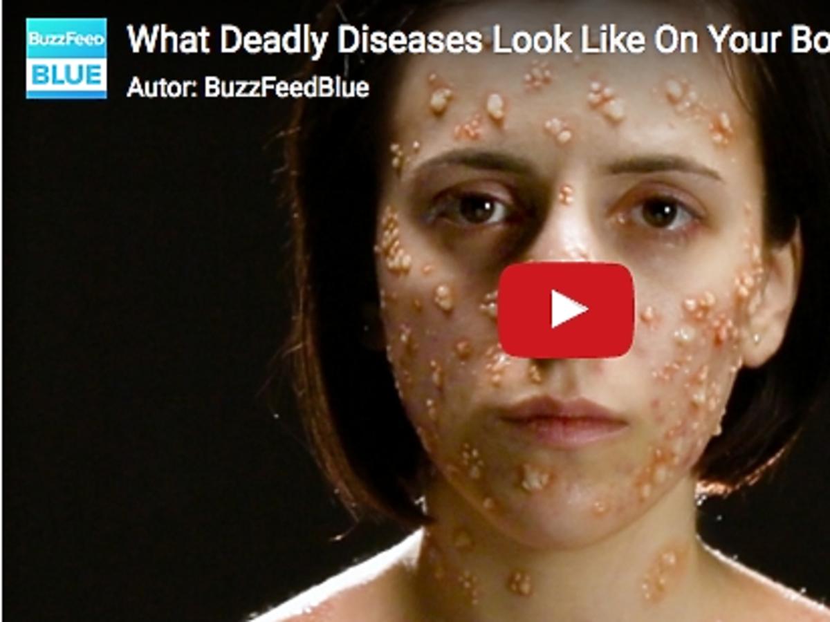 kadr z filmu What Deadly Diseases Look Like On Your Body
