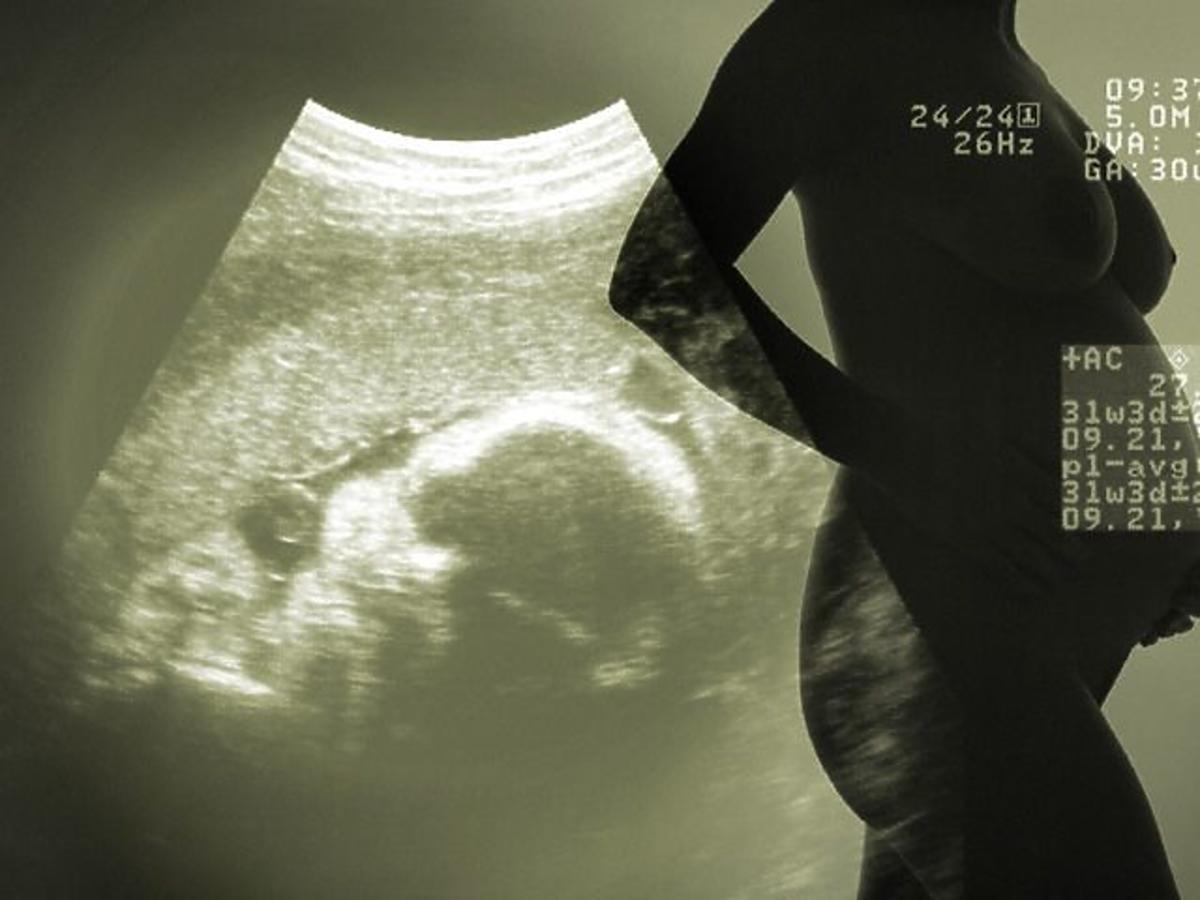 kobieta, ciąża, usg, płód, zdjęcie