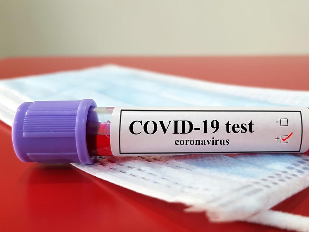 Koronawirus: brak testów na COVID-19. Zakażonych jest nawet 10 razy więcej?