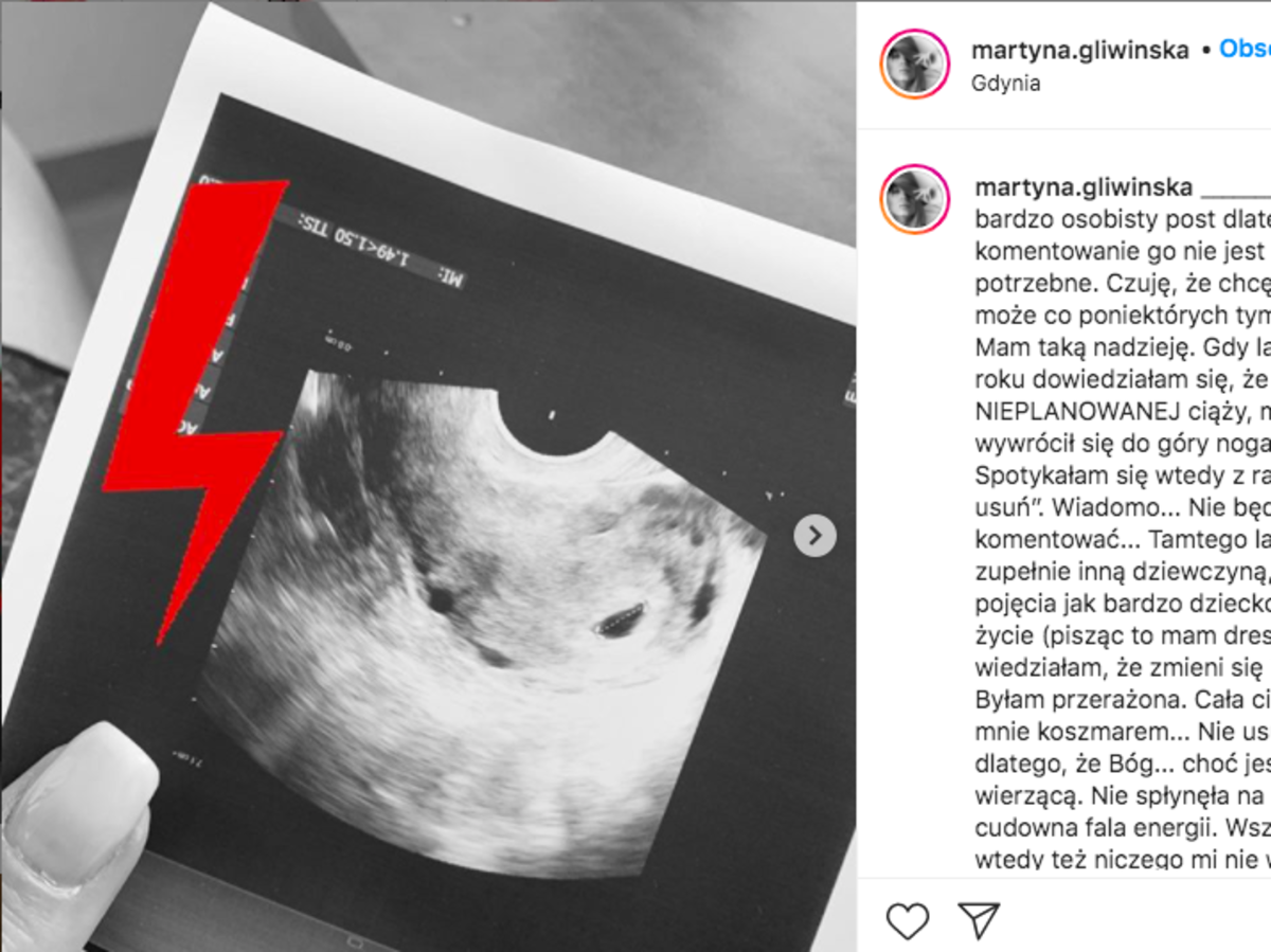 Martyna Gliwińska o nieplanowanej ciąży
