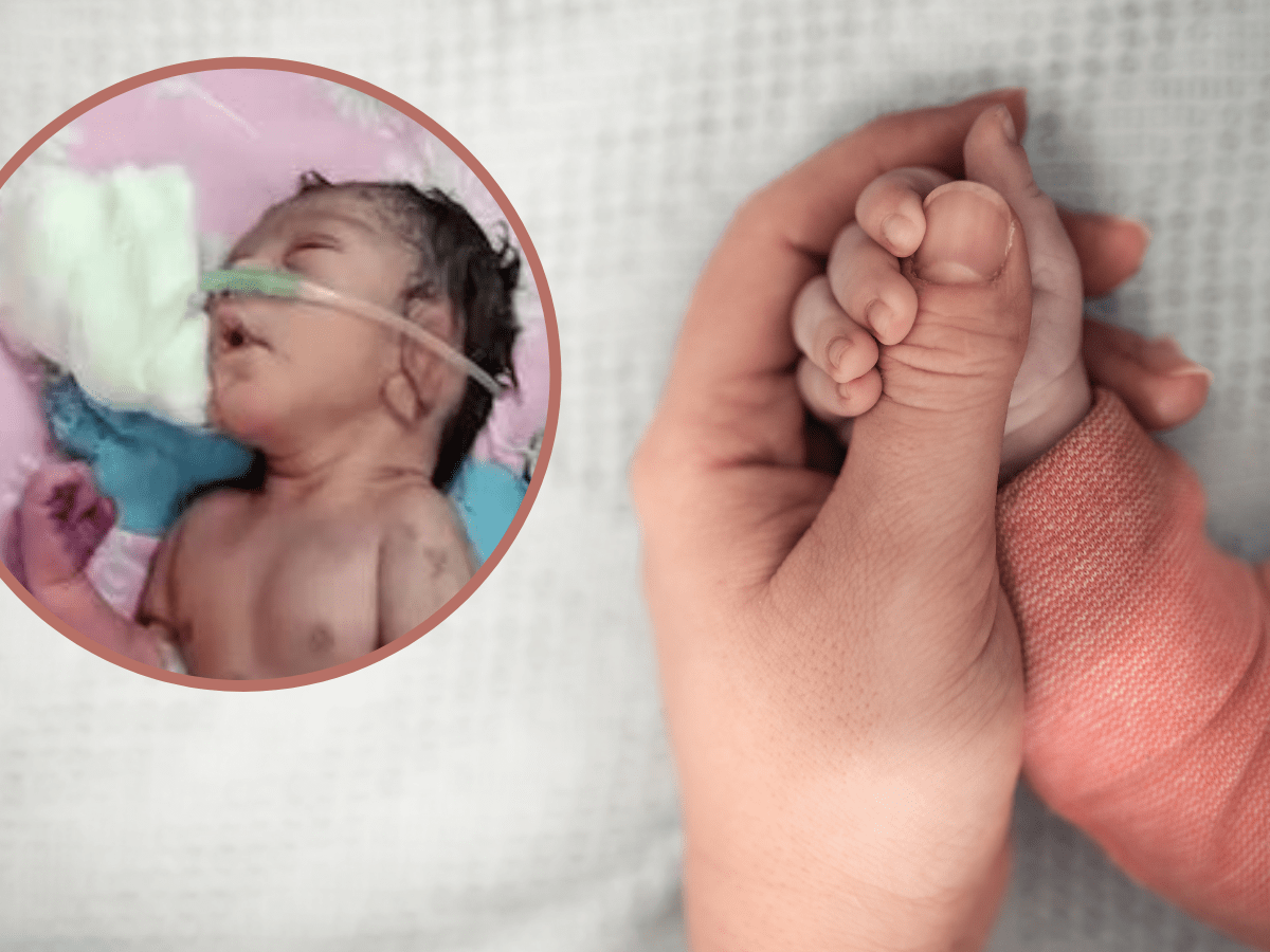 Niezwykłe dziecko-syrena: urodziło się z rogiem zamiast nóg