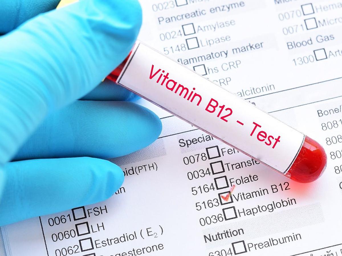 Objawy niedoboru witaminy B12