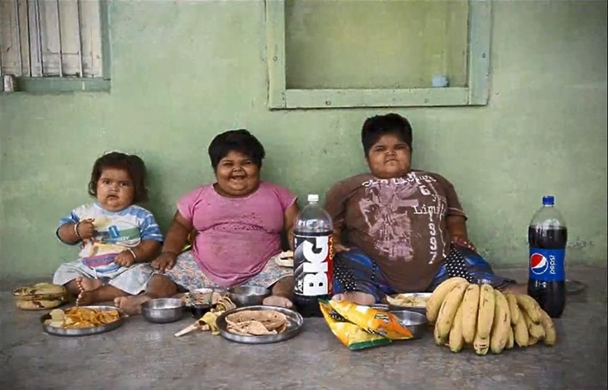 Otyłe dzieci z Indii, których ojciec chce sprzedać nerkę