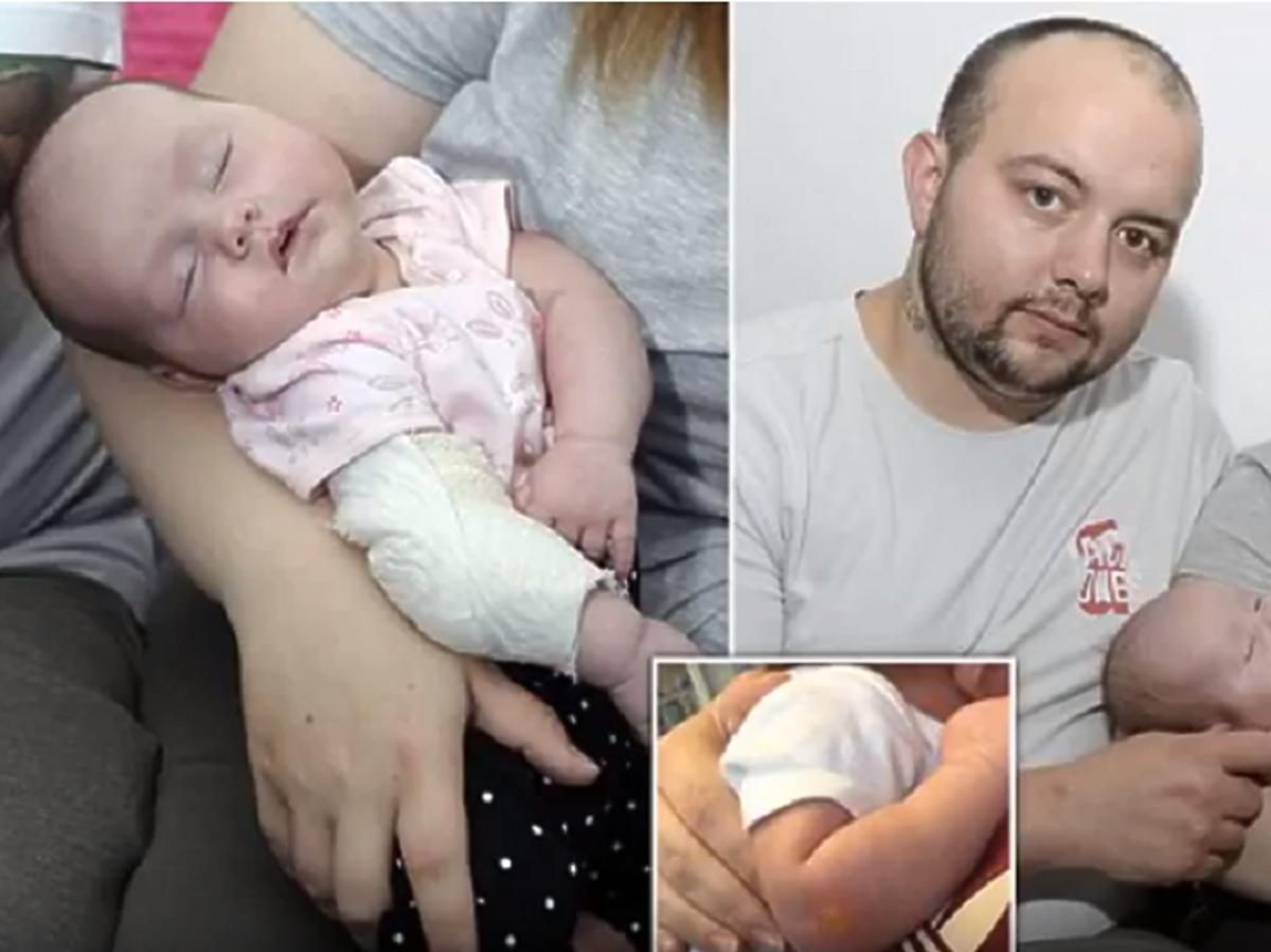 poparzenie dziecka papierosem 
