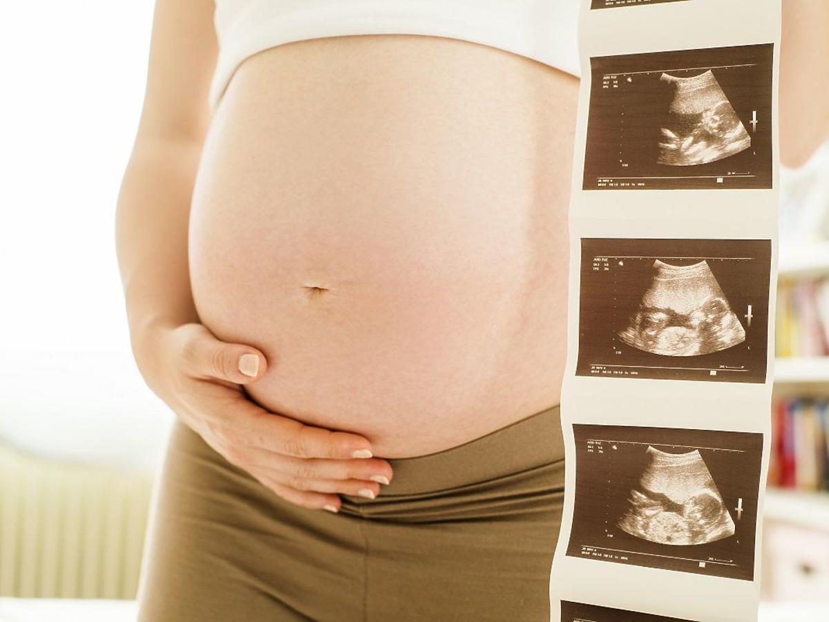 Popularne badania prenatalne