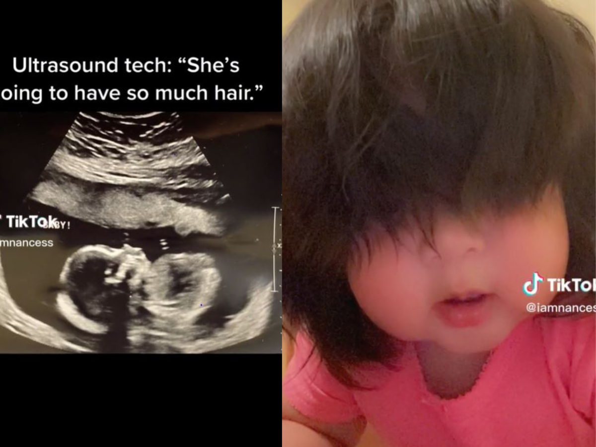 Powiedzieli jej, że jej córka będzie miała dużo włosów… Ale tego się nie spodziewała!