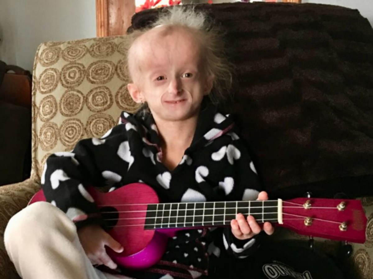 progeria 