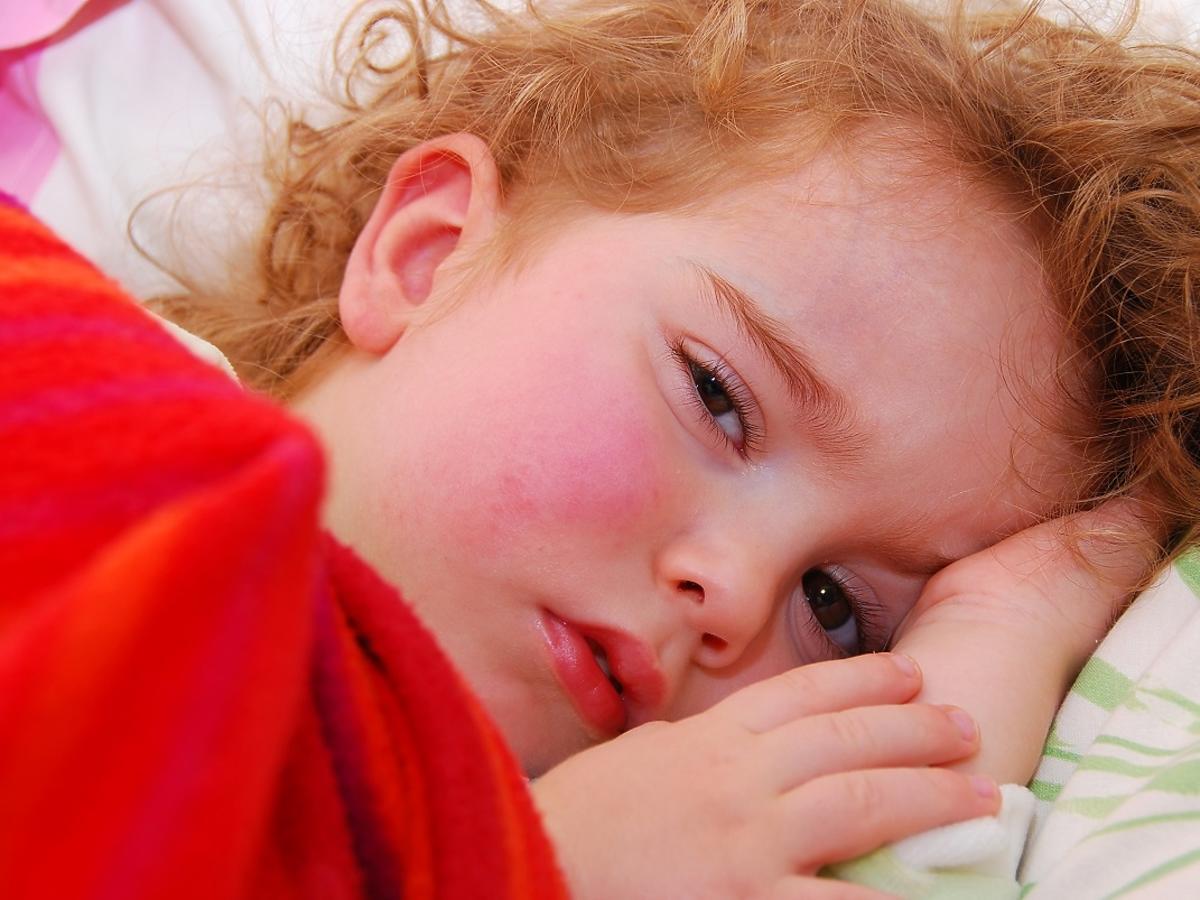 rośnie liczba alergii u dzieci
