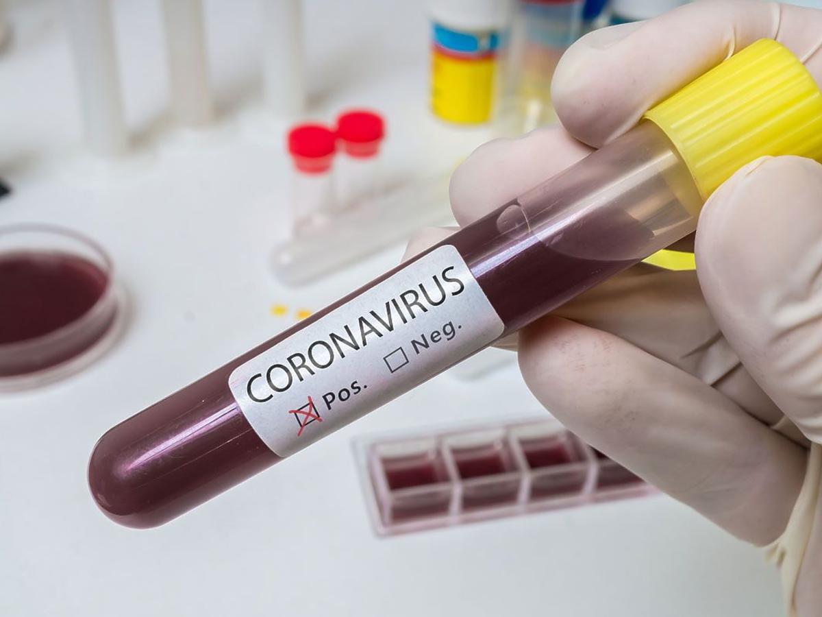 szczepionka przeciw koronawirusowi