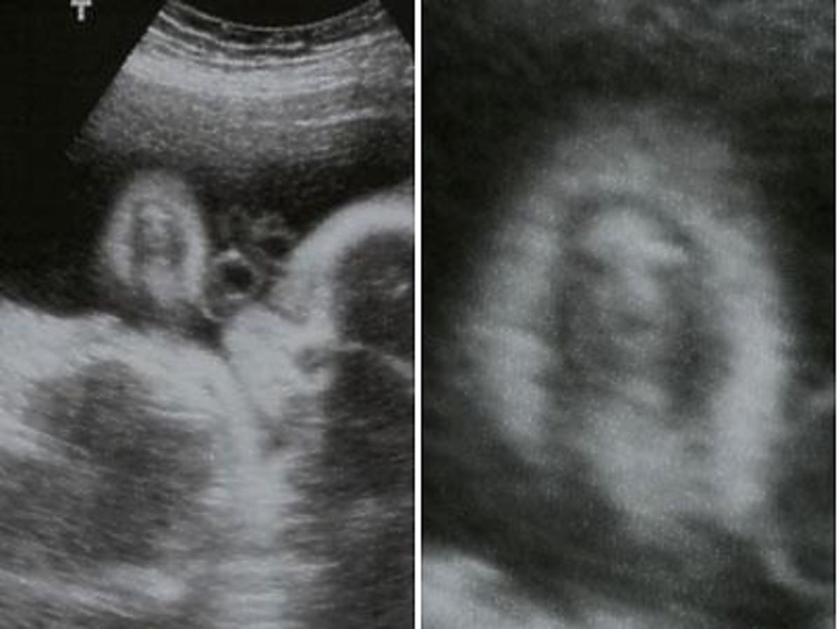 Dziwne miny dziecka na USG w ciąży