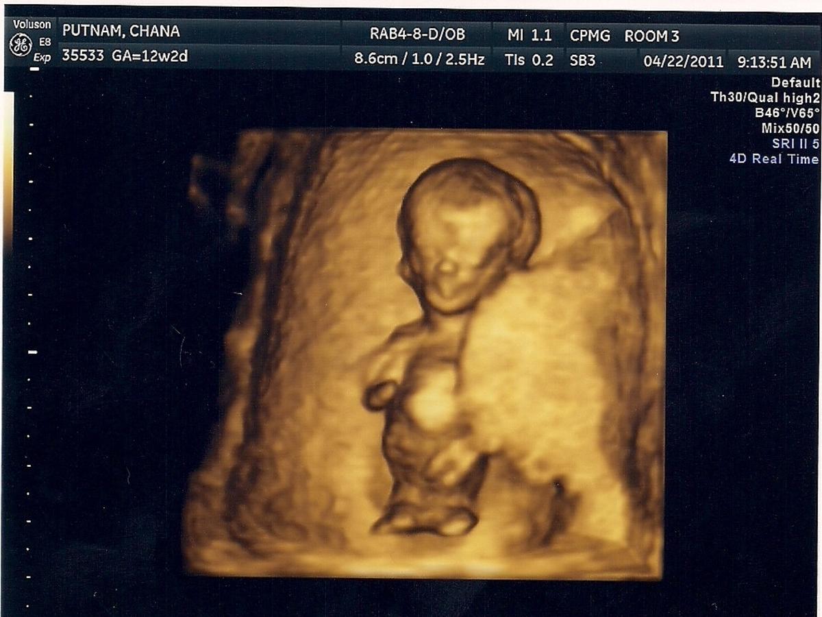 Dziecko na USG w ciąży