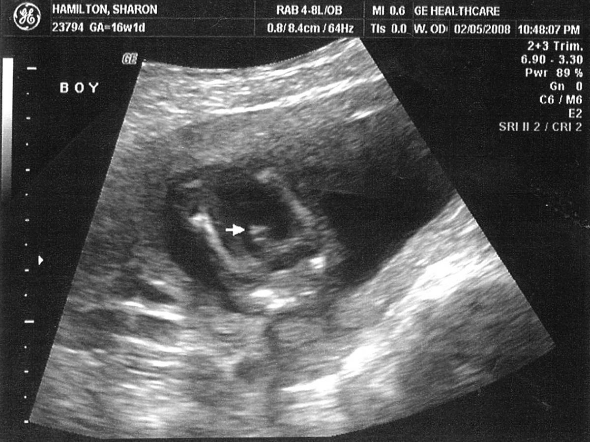 Chłopiec na USG w ciąży