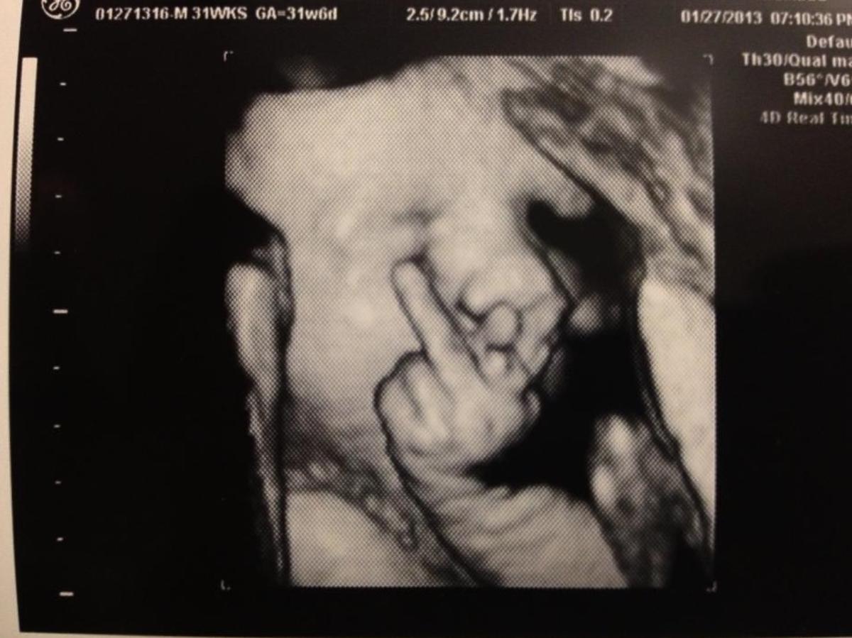 Śmieszny gest dziecka na USG w ciąży