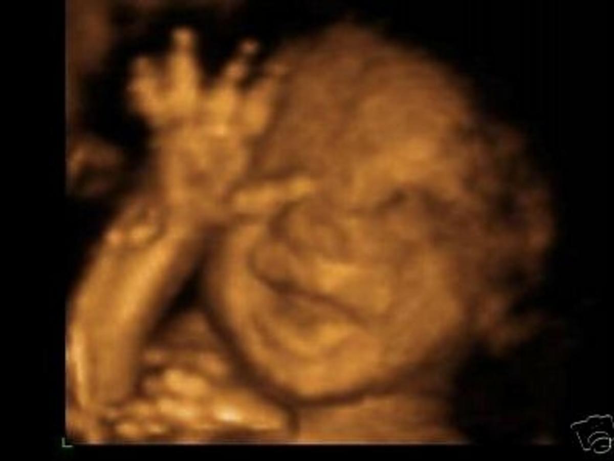 usg w ciąży, zdjęcie z usg, zdjęcie płodu, uśmiech dziecka na USG, śmieszna mina dziecka na USG