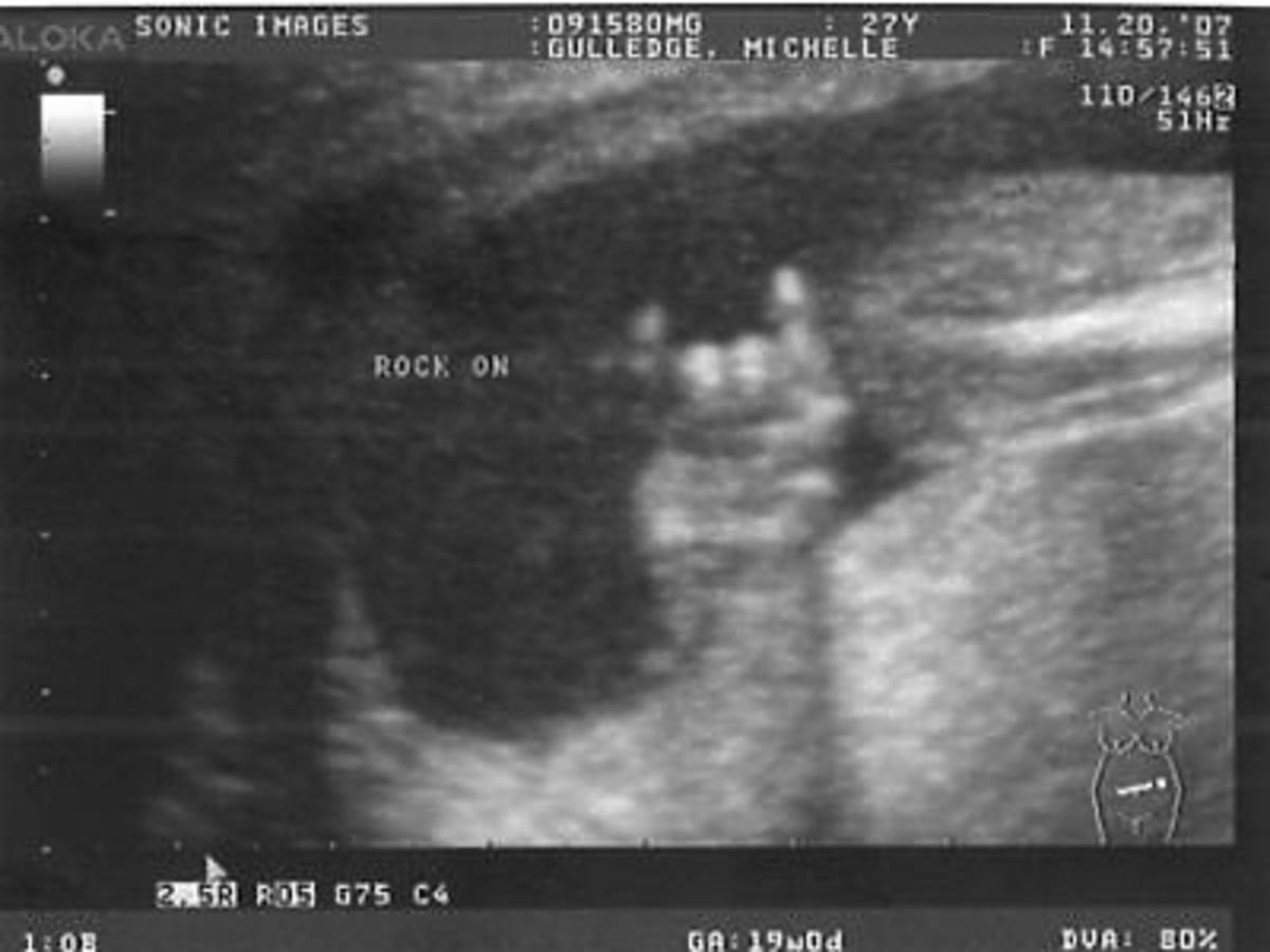 Rockowy gest dziecka na USG w ciąży