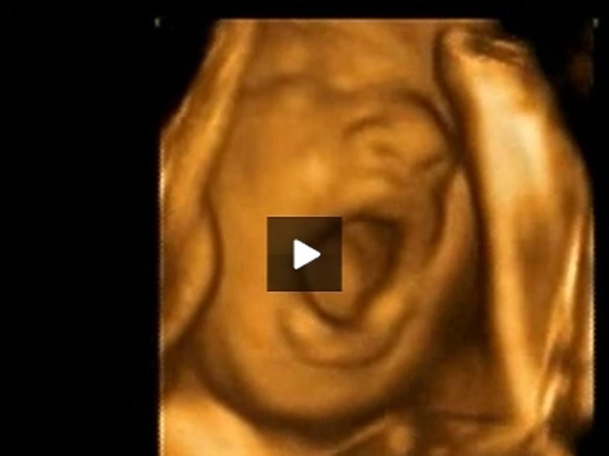 usg w ciąży, zdjęcie z usg, zdjęcie płodu, ziewające dziecko, płód