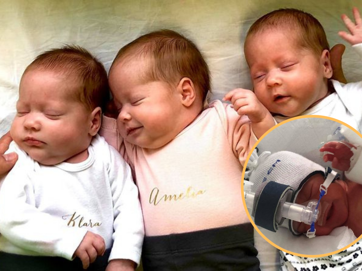 W Szczecinie urodziły sie niezwykłe trojaczki. Taka ciąża zdarza się raz na 500 tysięcy przypadków 