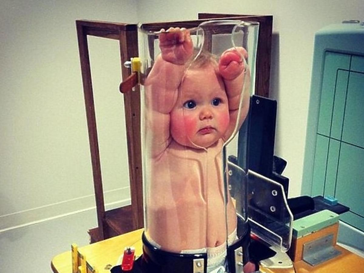 zdjęcie dziecka podczas badania rentgenowskiego - dziecko w tubie