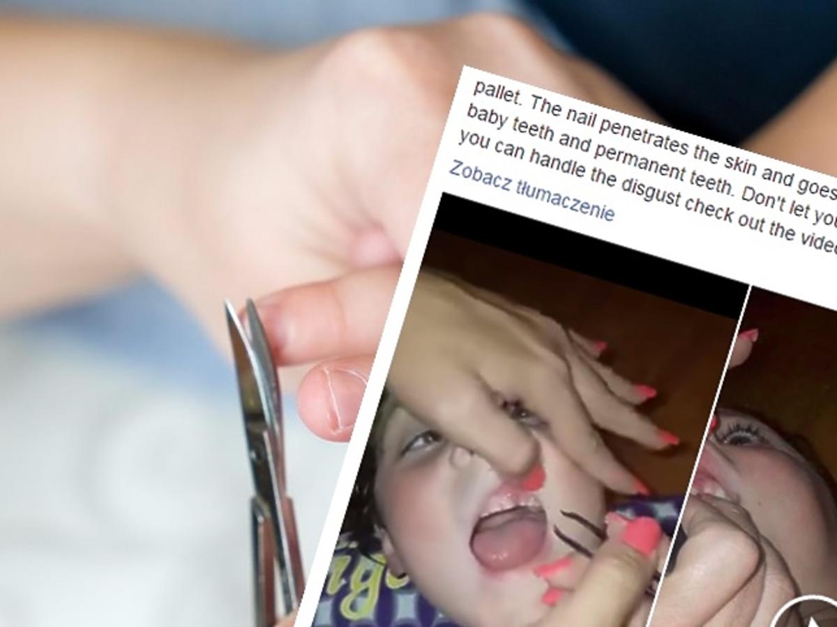 Obgryzanie paznokci u dziecka