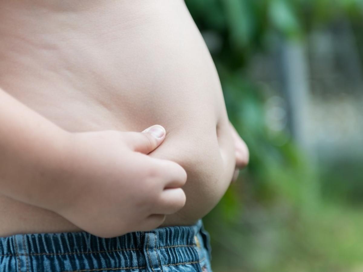 Otyłość i nadwaga u dzieci