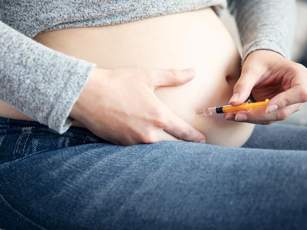 Zastrzyki przeciwzakrzepowe w ciąży