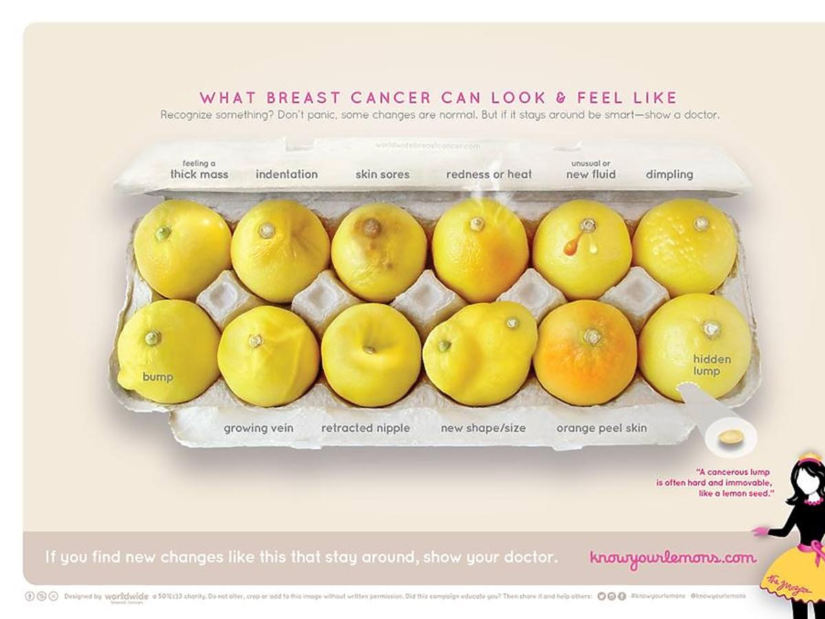 Zdjęcie kampanii Know Your Lemons informującej o raku piersi